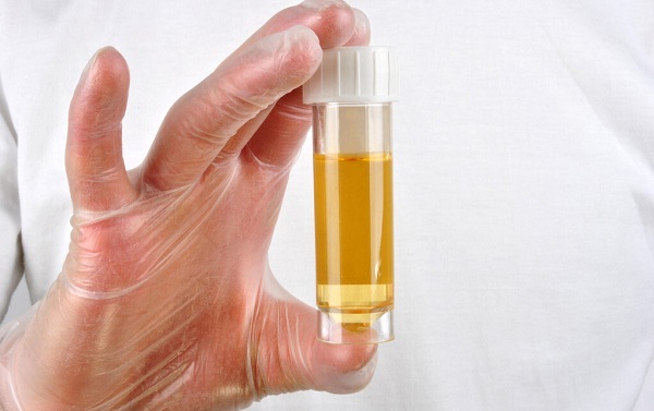 尿檢能檢測出來什么問題？